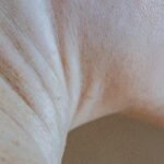 Facelift Acupunctuur: als de huid weer herinnert hoe ze moet herstellen